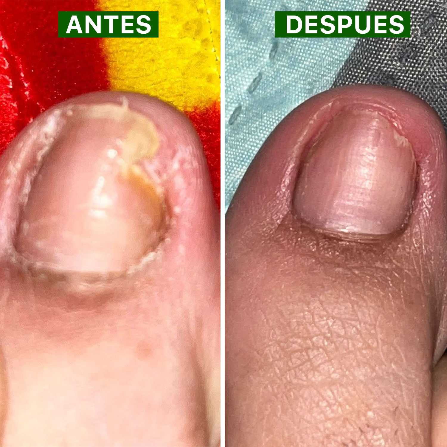 Aplicación con gotero